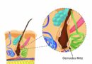 【病理解説シリーズ】まつげダニ編：生態や眼病を引き起こすメカニズムを調査！