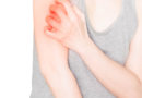 マツエクによって起きる「接触性皮膚炎」とは？症状の違いや原因を解説！