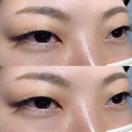 フラットラッシュ 一重