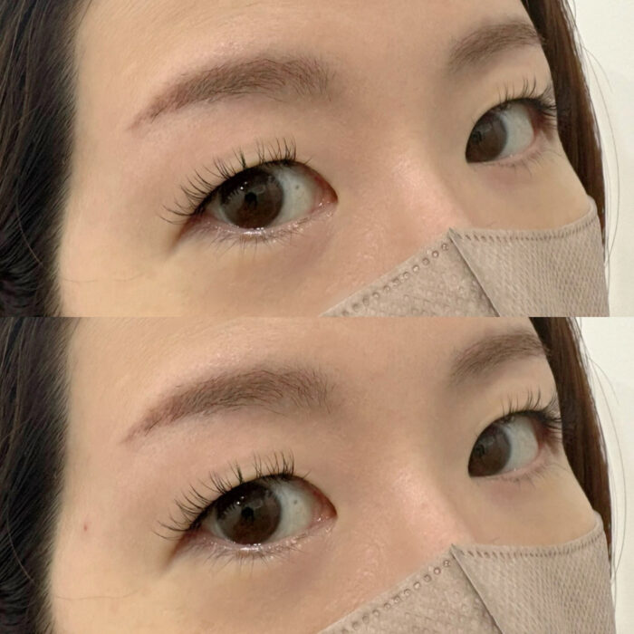 フラットラッシュ 一重