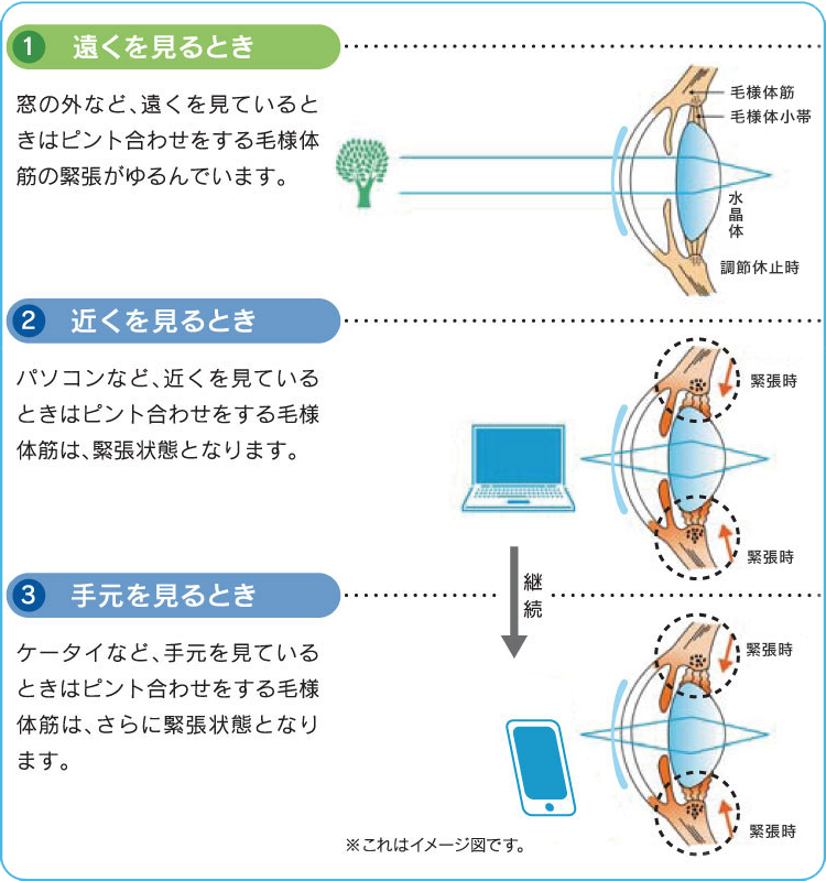 【アイリストあるある】施術中、目がかすむ。対策はある？まばたき体操やおすすめグッズを紹介｜Beauté（ボーテ）