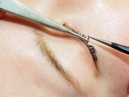 マツエク アレルギー