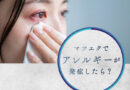 マツエクでアレルギーが発症したら?重症化させないポイントや低刺激性グルーを紹介