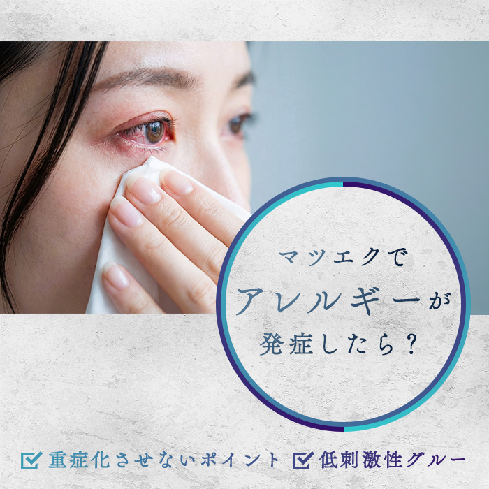 マツエクでアレルギーが発症したら？重症化させないポイントや低刺激性グルーを紹介
