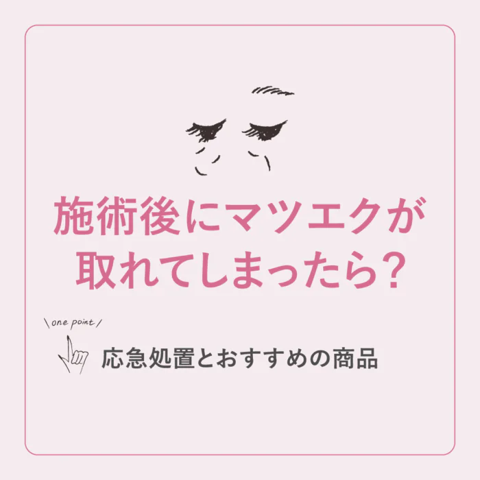 施術後にマツエクが取れてしまったら？応急処置のアドバイスとおすすめ商品